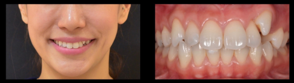 赤坂ヴィーナスデンタルクリニック