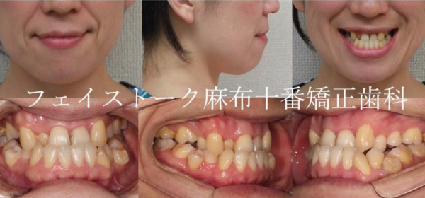 フェイストーク麻布十番矯正歯科