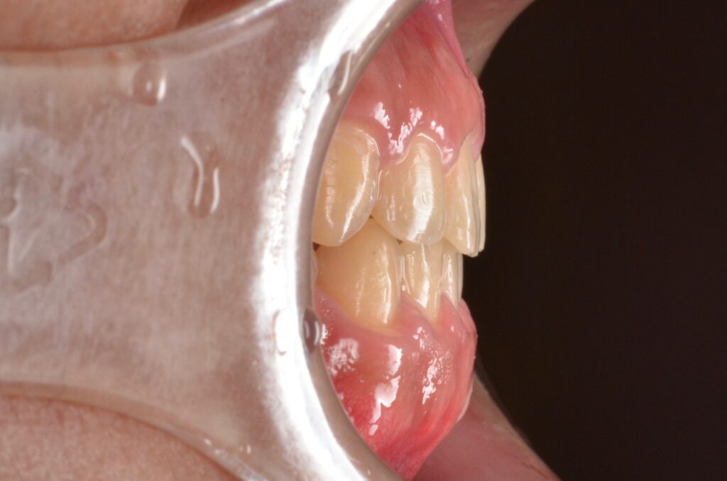 ビフォーアフター画像