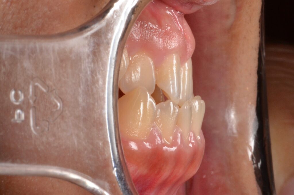 ビフォーアフター画像