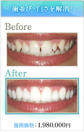 ビフォーアフター画像