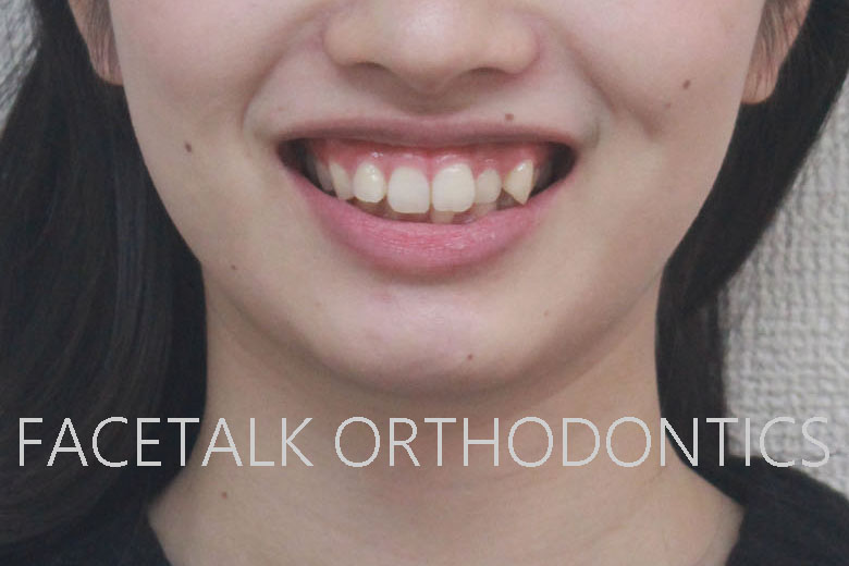 ビフォーアフター画像