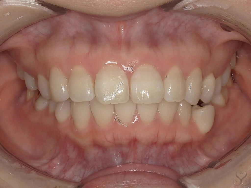 ビフォーアフター画像