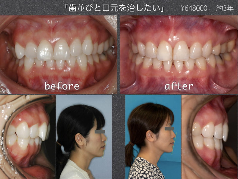 ビフォーアフター画像