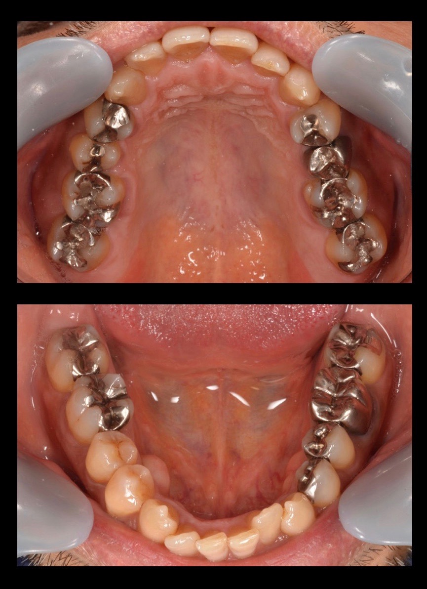 ビフォーアフター画像