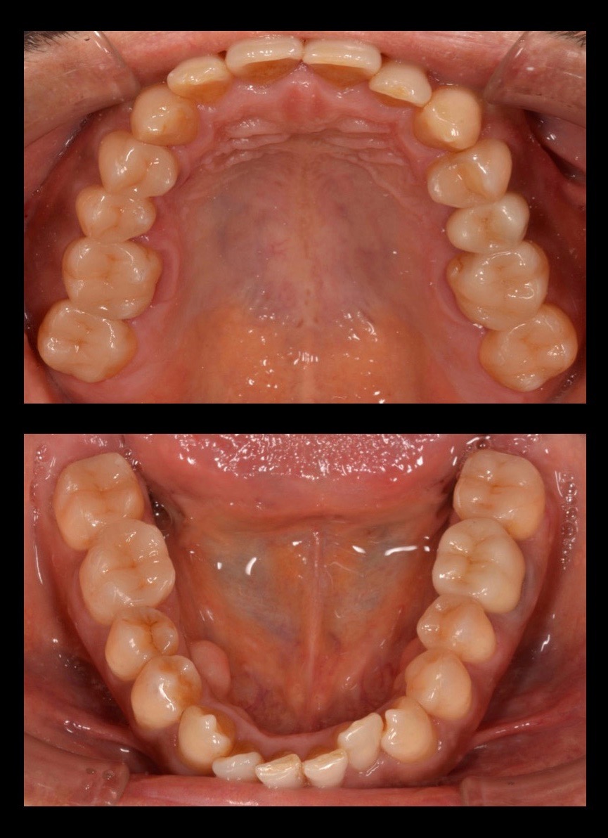 ビフォーアフター画像