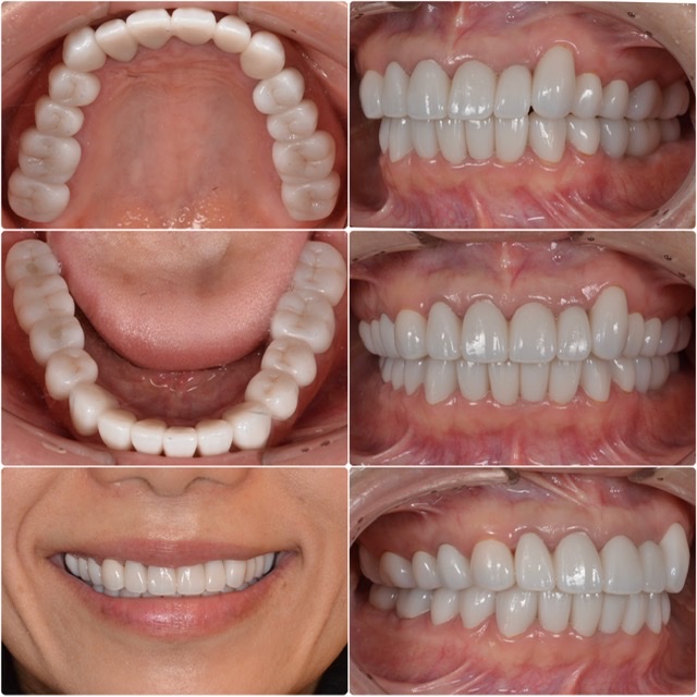 ビフォーアフター画像