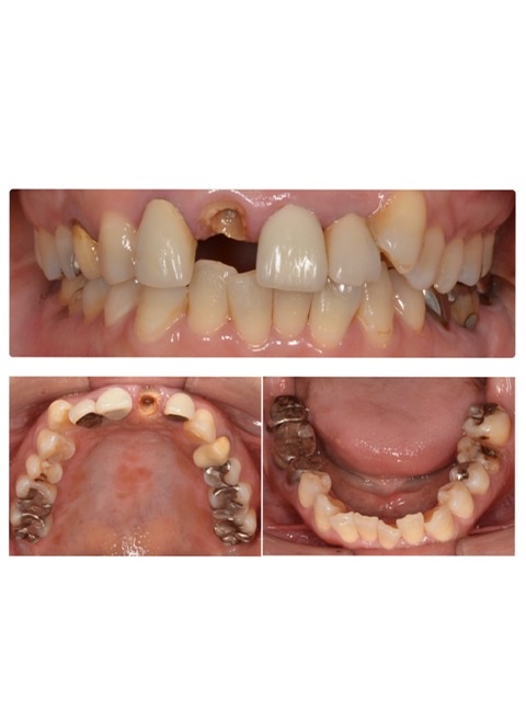 ビフォーアフター画像